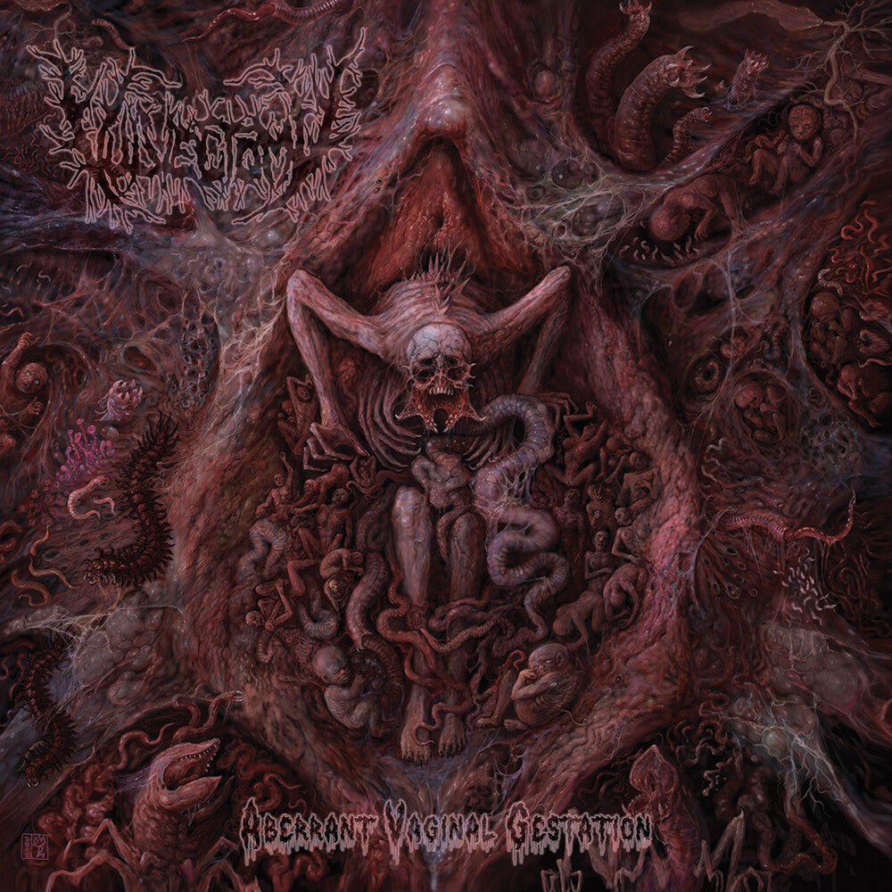 Vulvectomy - Aberrant Vaginal Gestation [CD] [New CD]