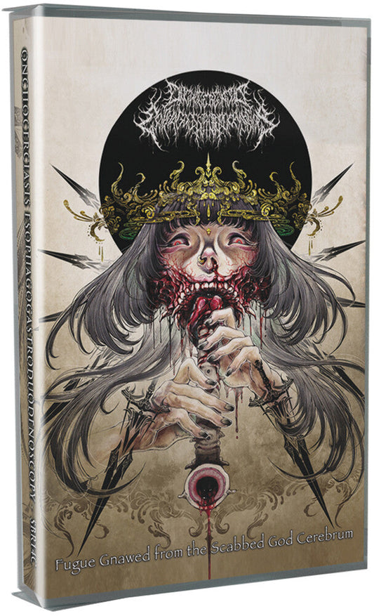 Onchocerciasis Esophagogastroduodenoscopy - Fugue Gnawed From the Scabbed God Cerebrum [Cassette] [New Cassette]